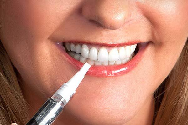 Как выбрать средство для отбеливания зубов