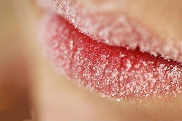 Как избавиться от сухости губ