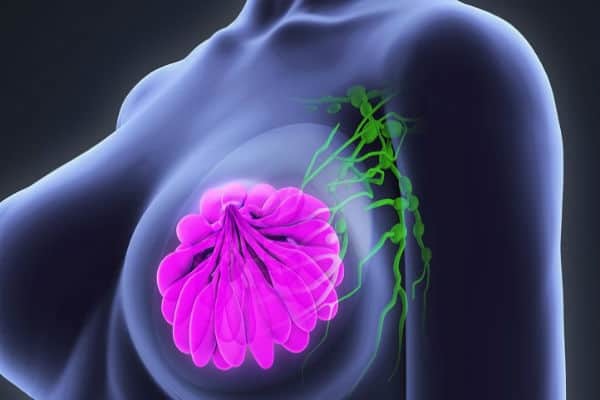 Ученые: польза аспирина при раке груди - спорный вопрос