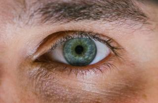 10 причин, почему у вас тёмные круги под глазами и как их исправить!