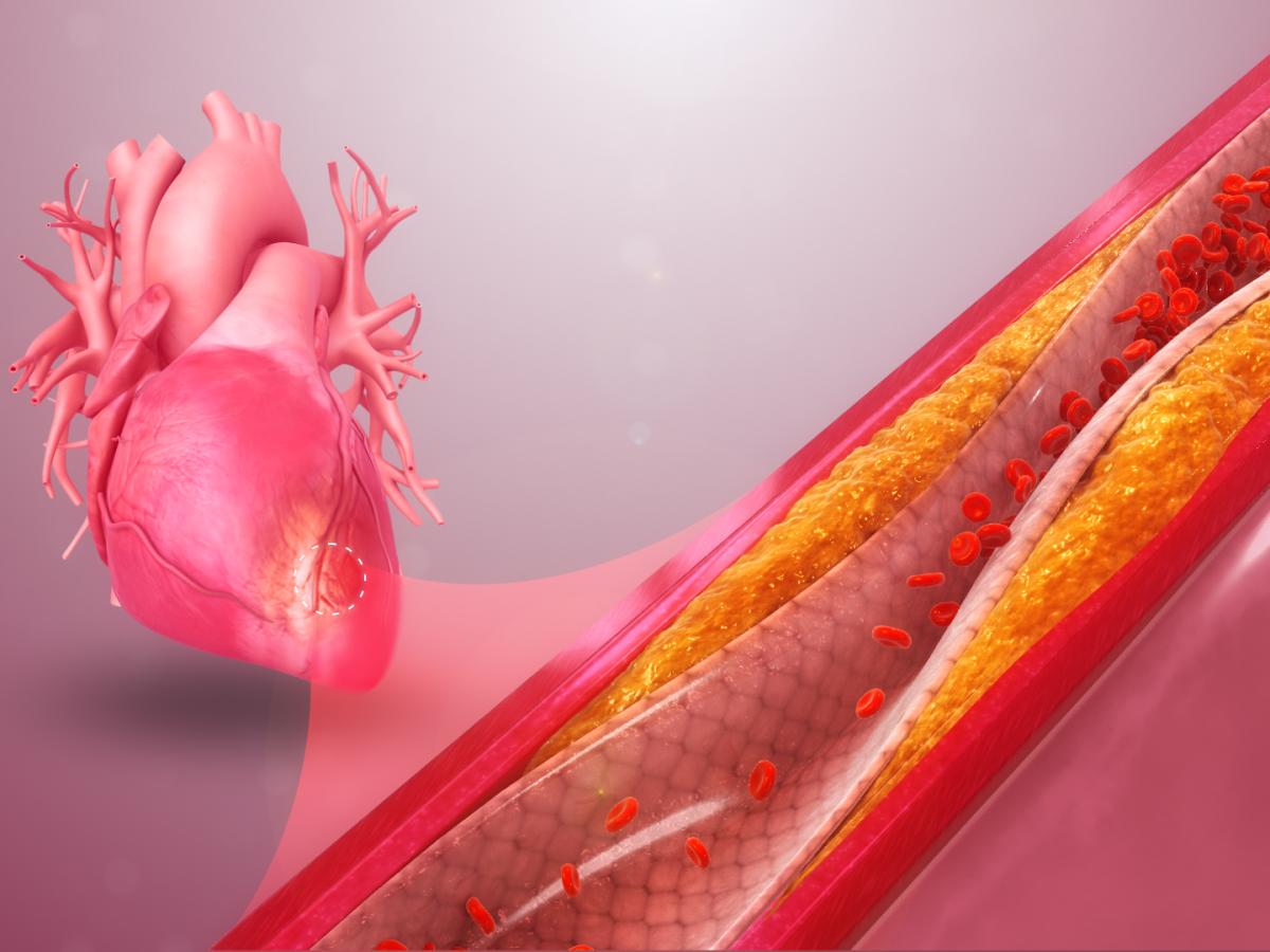 Как питание влияет на холестерин: продукты, повышающие и понижающие уровень ЛПНП