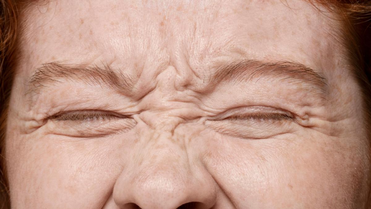 Морщина на глазах