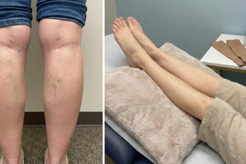 Закон четырех окон: эксперт Ксения Трофимова о том, как рассчитать идеальную длину ног и исправить их форму