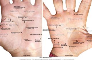 Планируйте запасы: какие продукты для диабетиков имеют долгий срок хранения