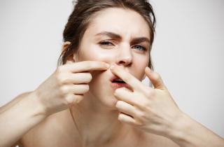 5 зон лица и прыщи: карта высыпаний расскажет о здоровье и уходе за кожей