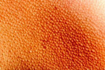 Шершавая кожа: признаки, причины, лечение