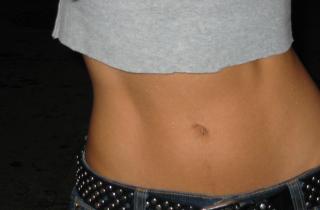 6 групп средств для похудения: как они обманывают ваши ожидания и вредят организму