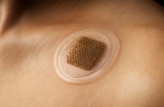 Микроиглы против ботокса: как домашние патчи совершили революцию в омоложении