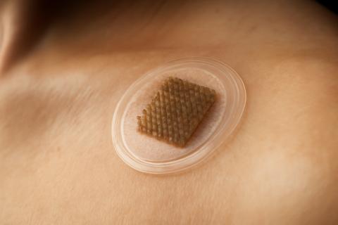 Микроиглы против ботокса: как домашние патчи совершили революцию в омоложении