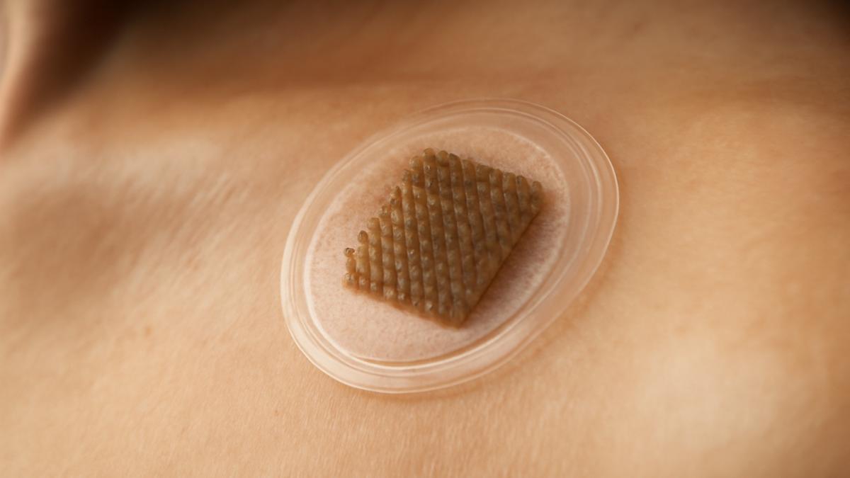 Микроиглы для мониторинга здоровья