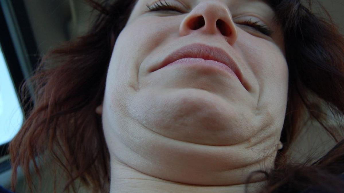 Двойной подбородок