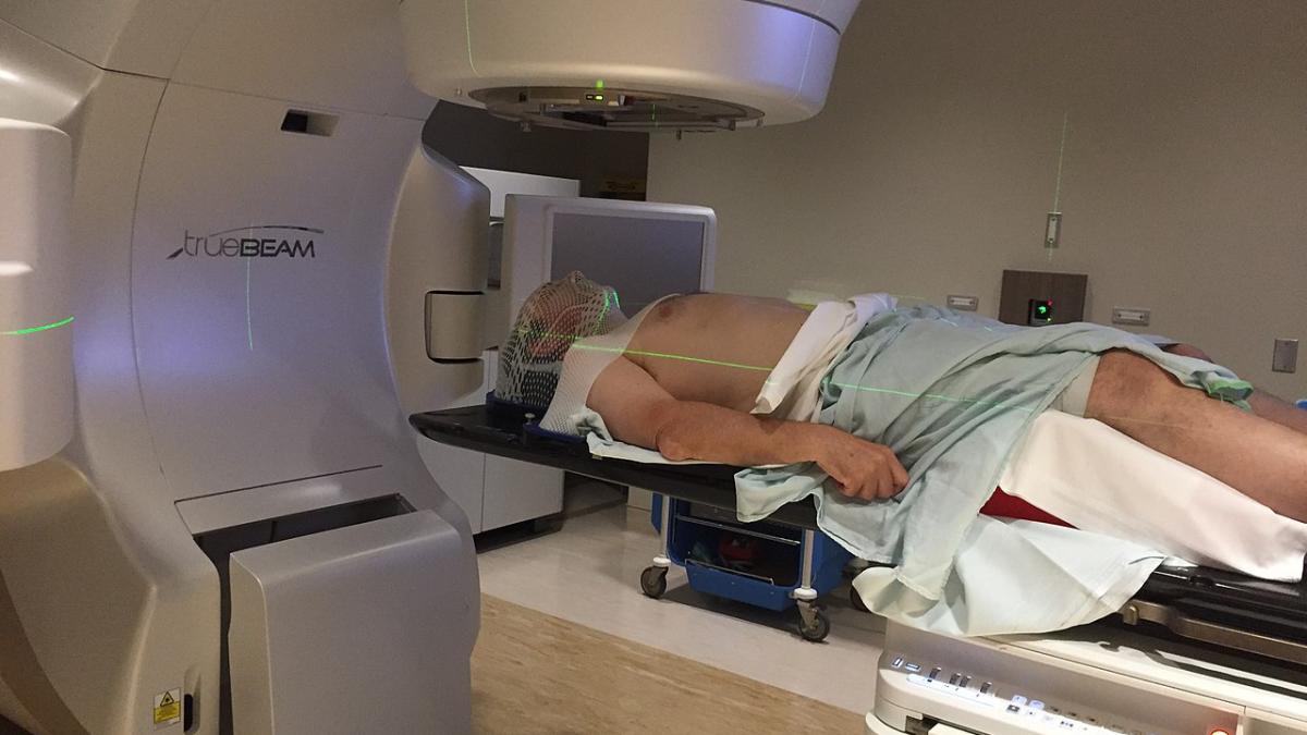 лучевая терапия