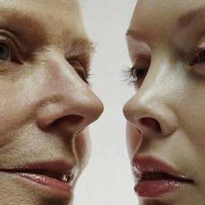 Двойной подбородок