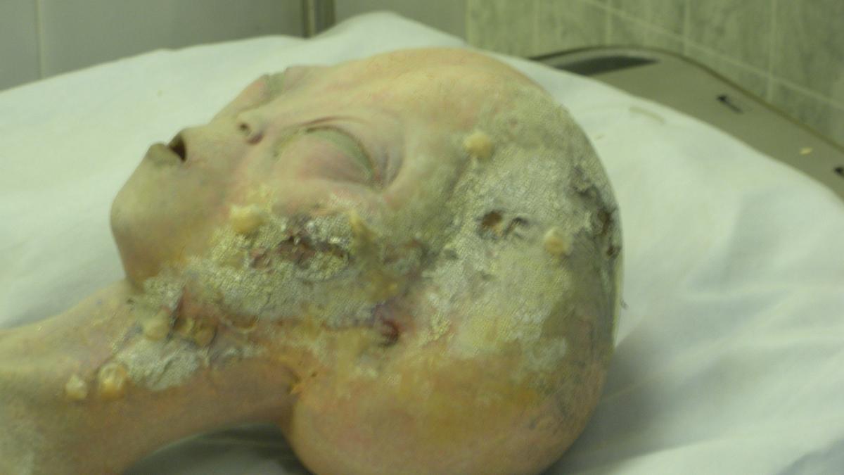 Музей НЛО в Розуэлле — Вскрытие пришельца