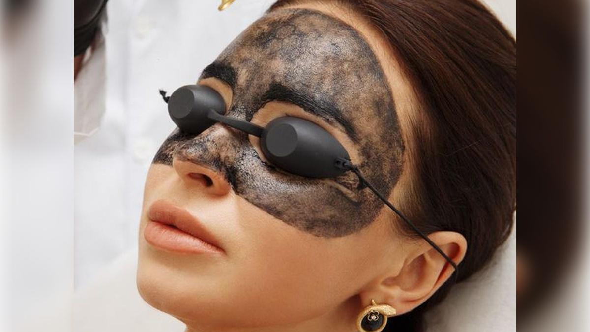 Карбоновый пилинг