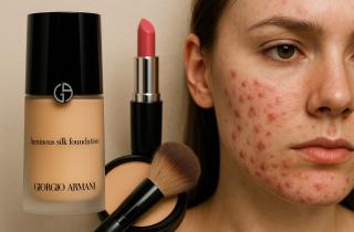 Акне на спине и декольте: 5 мифов, которые нужно перестать верить