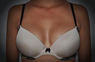 Как выбрать идеальную технику для маммопластики: умный подход к выбору